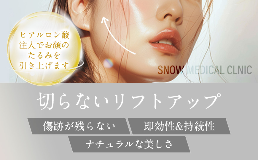 ヒアルロン酸注入でお顔のたるみを引き上げます。 切らないリフトアップ